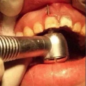 Keine Angst vorm Zahnartzt