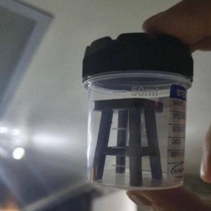 stuhlprobe