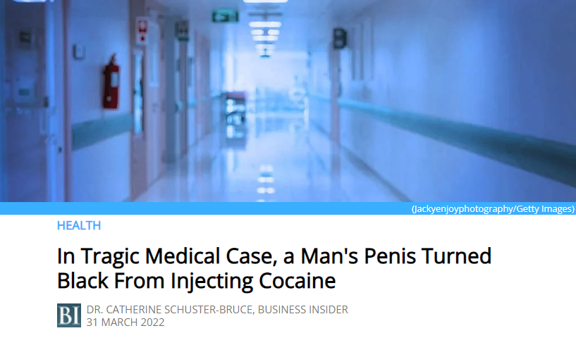 Auer