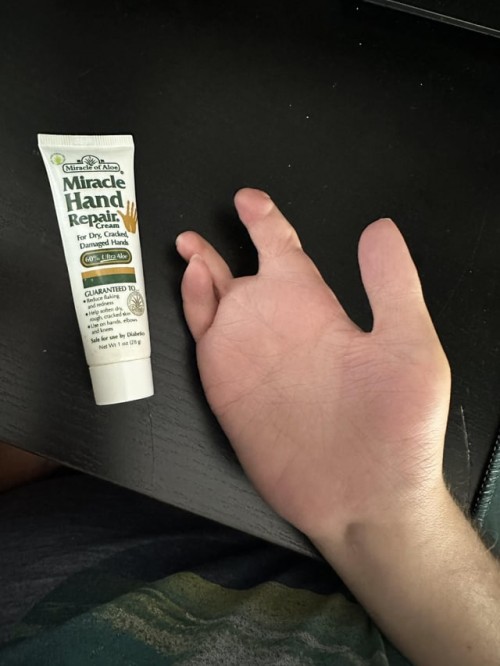 Kleine Grübblhand